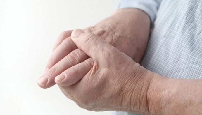 a kezek arthrosisának kezelésének eszközei